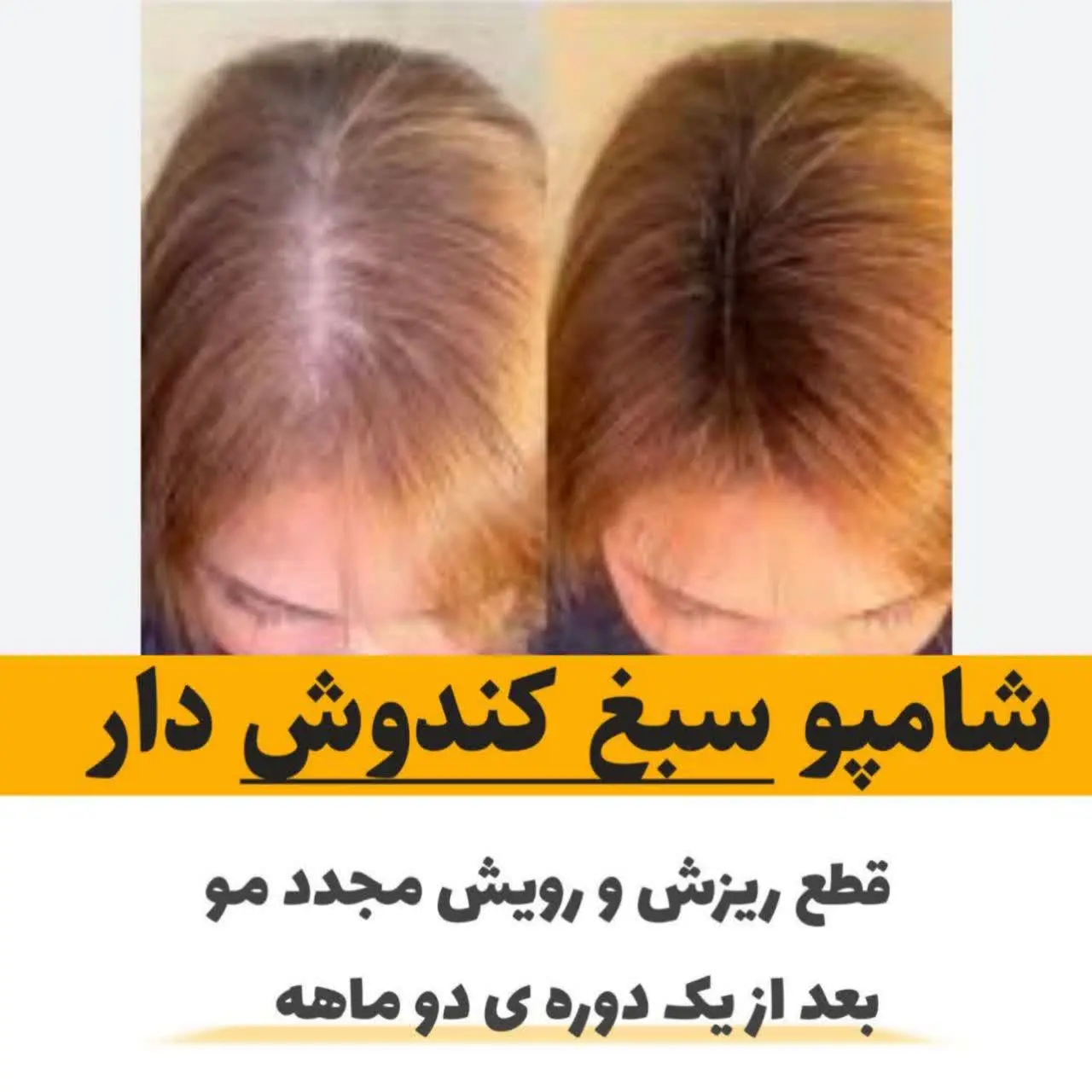 خداحافظی با ریزش مو 😍🎉
