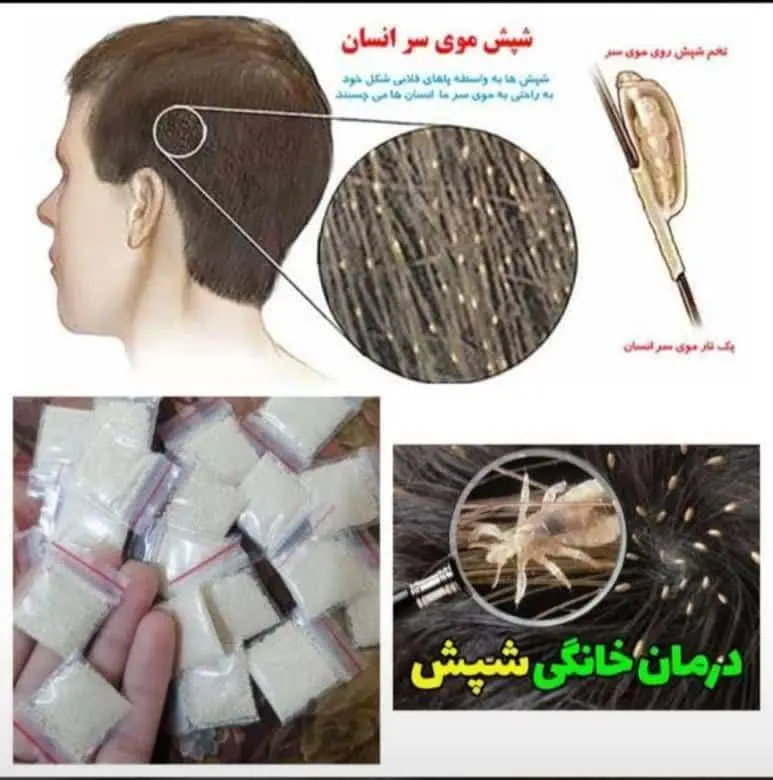 طریقه استفاده هر ۱بسته پودر و داخل ۱ لیوان آب ولرم حل کنید و با آپاش اسپری کنید به کل کف سر تا ریشه و ساقه مو ۱۲ ساعت حمام نروید بعد ۱۲ ساعت حمام بروید سر را شامپو بزنید و با شونه شپش زیر دو