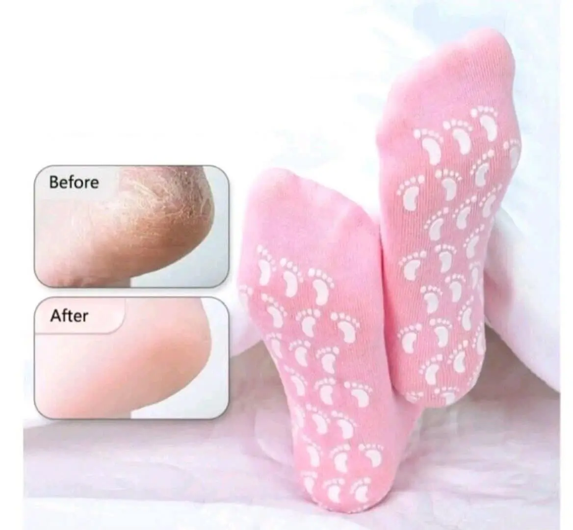 جوراب سیلیکونی درجه یک🧦 😍
