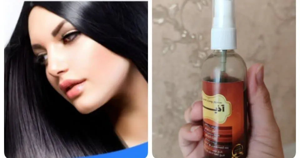 😊👌اگه چربی کف سر داری به راحتی با سرم بومبایا میتونی چربی سرتو تنظیم کنی حتی چربی سر ارثی رو