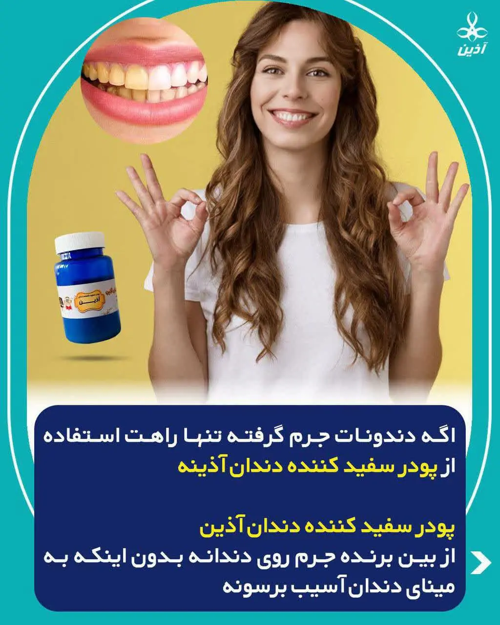😬دندونهای زرد نشان دهنده شخصیه که حال رسیدگی به دندنهاشو نداره